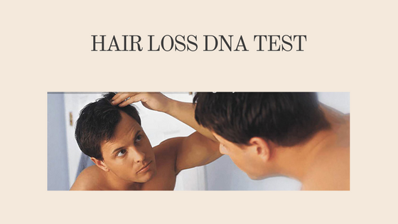 Things You Should Know About Hair Loss